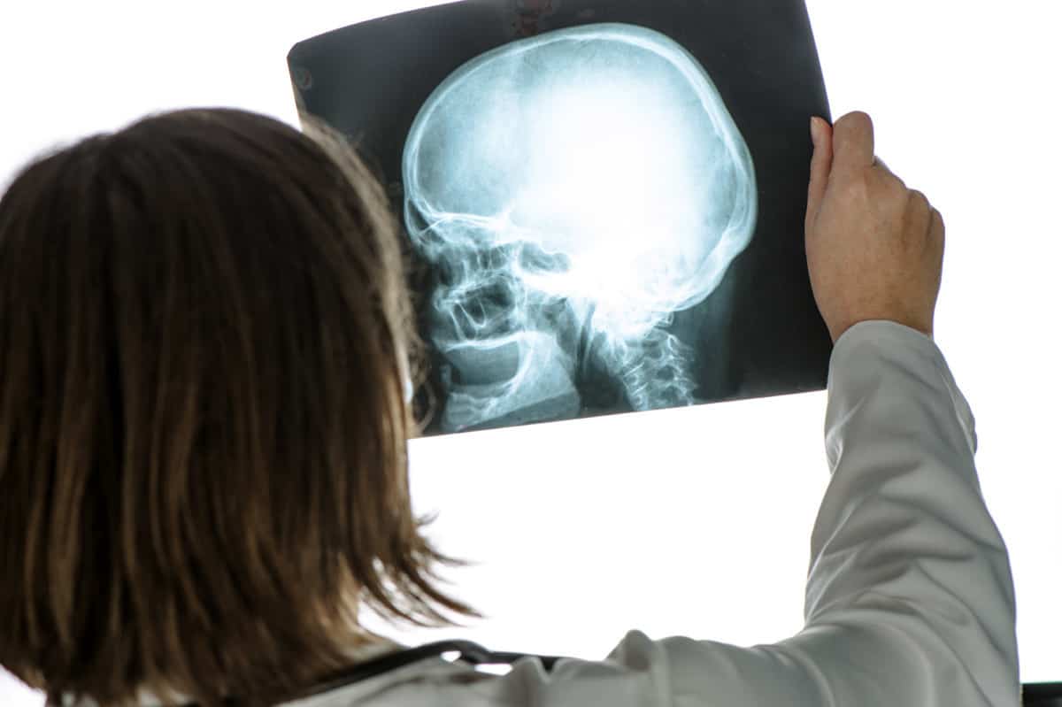 Can an Air Rifle Penetrate a Human Skull?